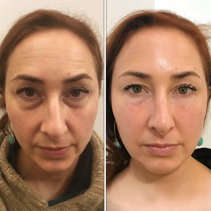 Restorative Eye Masks